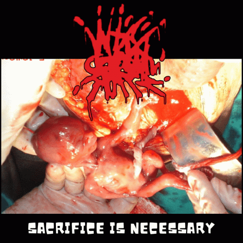 Sacrifice Is Necessary